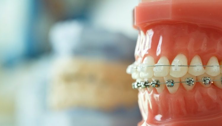  İstanbul Ortodonti Uzmanları