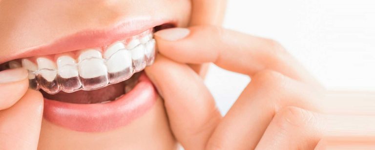 İstanbul Ortodontist Önerileri